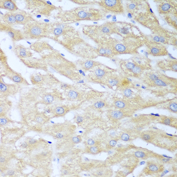 Immunohistochemistry of paraffin-embedded Human liver using NUDT15 Polyclonal Antibody at dilution of  1:100 (40x lens).