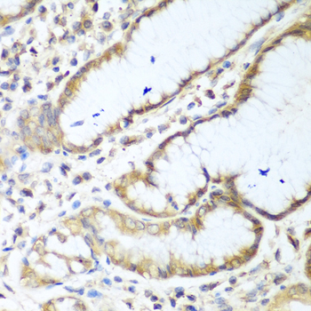 Immunohistochemistry of paraffin-embedded Human stomach using NUDT15 Polyclonal Antibody at dilution of  1:100 (40x lens).
