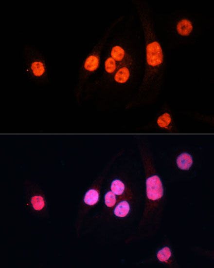 Immunofluorescence analysis of HeLa cells using METTL3 Polyclonal Antibody at dilution of  1:100 (40x lens). Blue: DAPI for nuclear staining.