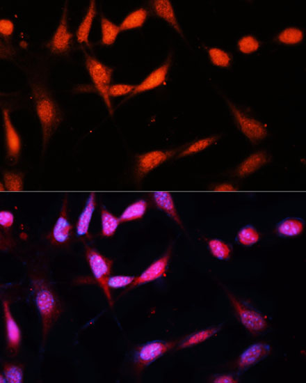 Immunofluorescence analysis of NIH/3T3 cells using METTL3 Polyclonal Antibody at dilution of  1:100 (40x lens). Blue: DAPI for nuclear staining.