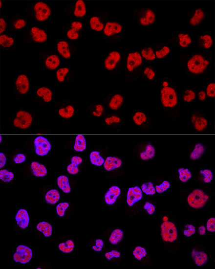 Confocal immunofluorescence analysis of Hela cells using METTL3 Polyclonal Antibody at dilution of  1:200. Blue: DAPI for nuclear staining.