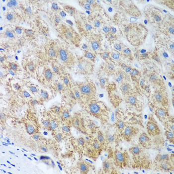 Immunohistochemistry of paraffin-embedded Human liver using UBE2U Polyclonal Antibody at dilution of  1:100 (40x lens).