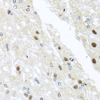 Immunohistochemistry of paraffin-embedded Rat brain using YTHDF3 Polyclonal Antibody at dilution of  1:100 (40x lens).