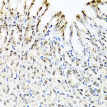 Immunohistochemistry of paraffin-embedded Mouse stomach using YTHDF3 Polyclonal Antibody at dilution of  1:100 (40x lens).