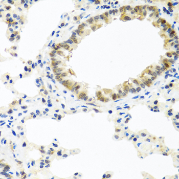 Immunohistochemistry of paraffin-embedded Rat lung using BMP5 Polyclonal Antibody at dilution of  1:100 (40x lens).