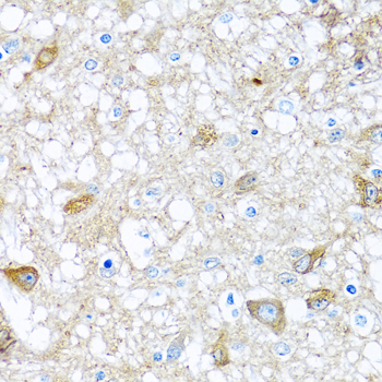 Immunohistochemistry of paraffin-embedded Rat brain using BMP5 Polyclonal Antibody at dilution of  1:100 (40x lens).