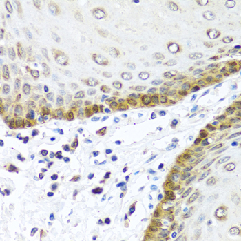 Immunohistochemistry of paraffin-embedded Human esophagus using BMP5 Polyclonal Antibody at dilution of  1:100 (40x lens).