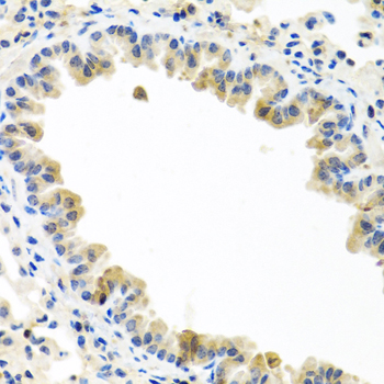 Immunohistochemistry of paraffin-embedded Mouse lung using BMP5 Polyclonal Antibody at dilution of  1:100 (40x lens).