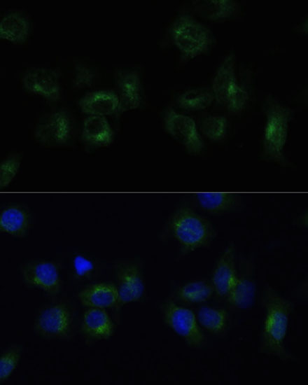 Immunofluorescence analysis of HeLa cells using CLTB Polyclonal Antibody at dilution of  1:100 (40x lens). Blue: DAPI for nuclear staining.