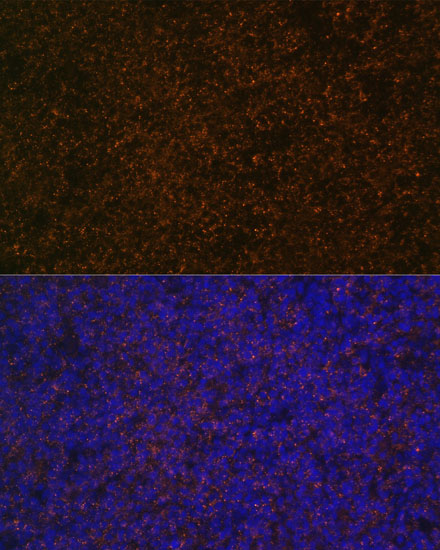 Immunofluorescence analysis of Rat spleen using CR2 Polyclonal Antibody at dilution of  1:100 (40x lens). Blue: DAPI for nuclear staining.