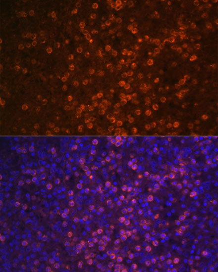 Immunofluorescence analysis of Human spleen using CR2 Polyclonal Antibody at dilution of  1:100 (40x lens). Blue: DAPI for nuclear staining.