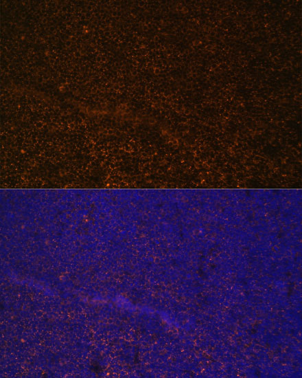 Immunofluorescence analysis of Mouse spleen using CR2 Polyclonal Antibody at dilution of  1:100 (40x lens). Blue: DAPI for nuclear staining.