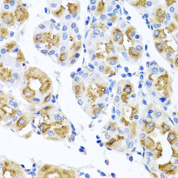 Immunohistochemistry of paraffin-embedded Human stomach using FECH Polyclonal Antibody at dilution of  1:100 (40x lens).