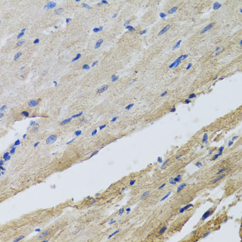Immunohistochemistry of paraffin-embedded Rat heart using FECH Polyclonal Antibody at dilution of  1:100 (40x lens).