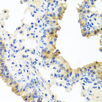 Immunohistochemistry of paraffin-embedded Mouse lung using FECH Polyclonal Antibody at dilution of  1:100 (40x lens).