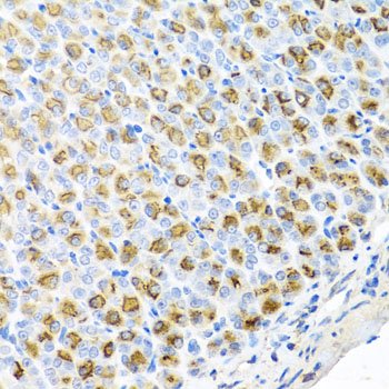 Immunohistochemistry of paraffin-embedded Mouse stomach using FECH Polyclonal Antibody at dilution of  1:100 (40x lens).