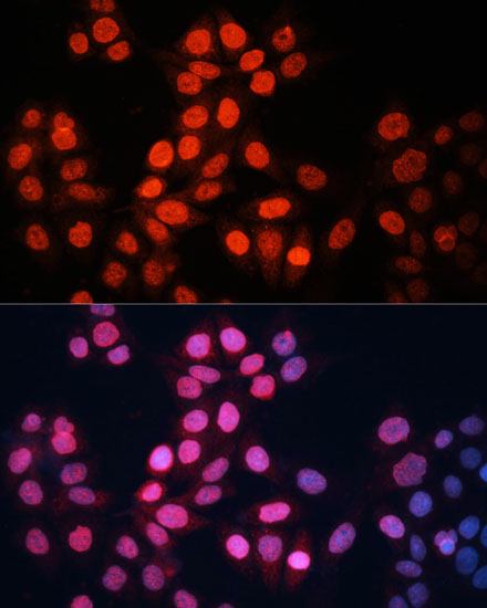 Immunofluorescence analysis of HeLa cells using GABPA Polyclonal Antibody at dilution of  1:100 (40x lens). Blue: DAPI for nuclear staining.