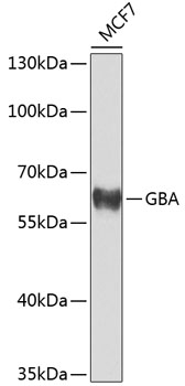 Western blot analysis of extracts of MCF-7 cells using GBA Polyclonal Antibody at dilution of 1:1000.
