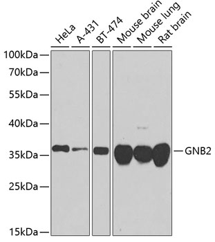 Western blot analysis of extracts of various cell lines using GNB2 Polyclonal Antibody at dilution of 1:1000.