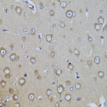 Immunohistochemistry of paraffin-embedded Rat brain using ITGB8 Polyclonal Antibody at dilution of  1:100 (40x lens).