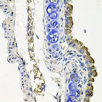 Immunohistochemistry of paraffin-embedded Mouse lung using MARK1 Polyclonal Antibody at dilution of  1:100 (40x lens).