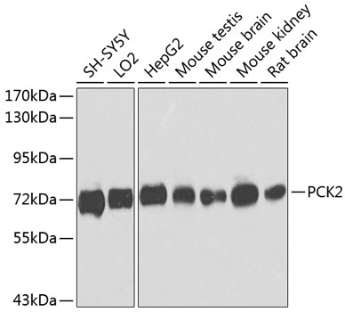 Western blot analysis of extracts of various cell lines using PCK2 Polyclonal Antibody at dilution of 1:1000.