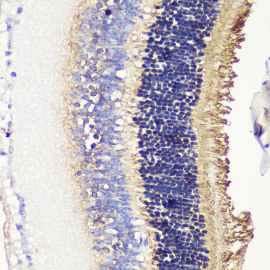 Immunohistochemistry of paraffin-embedded Mouse retina using PDC Polyclonal Antibody at dilution of  1:200 (40x lens).