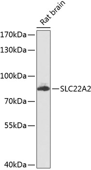 Western blot analysis of extracts of Rat brain using SLC22A2 Polyclonal Antibody at dilution of 1:1000.