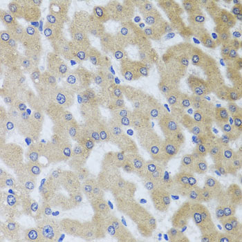 Immunohistochemistry of paraffin-embedded Human liver damage using UVRAG Polyclonal Antibody at dilution of  1:100 (40x lens).