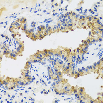 Immunohistochemistry of paraffin-embedded Mouse lung using UVRAG Polyclonal Antibody at dilution of  1:100 (40x lens).