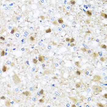 Immunohistochemistry of paraffin-embedded Rat brain using ZBTB17 Polyclonal Antibody at dilution of  1:100 (40x lens).