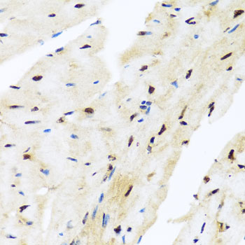 Immunohistochemistry of paraffin-embedded Mouse heart using ZBTB17 Polyclonal Antibody at dilution of  1:100 (40x lens).