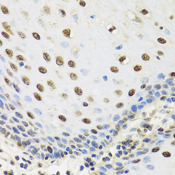 Immunohistochemistry of paraffin-embedded Human esophagus using TAF15 Polyclonal Antibody at dilution of  1:100 (40x lens).