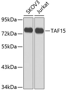 Western blot analysis of extracts of various cell lines using TAF15 Polyclonal Antibody at dilution of 1:1000.