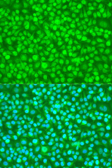 Immunofluorescence analysis of U2OS cells using N4BP1 Polyclonal Antibody at dilution of  1:100. Blue: DAPI for nuclear staining.