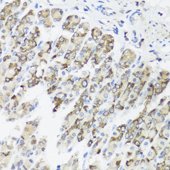 Immunohistochemistry of paraffin-embedded Mouse stomach using TIMM10B Polyclonal Antibody at dilution of  1:100 (40x lens).