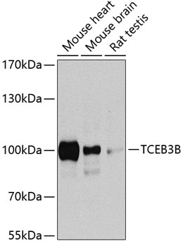 Western blot analysis of extracts of various cell lines using TCEB3B Polyclonal Antibody at dilution of 1:1000.