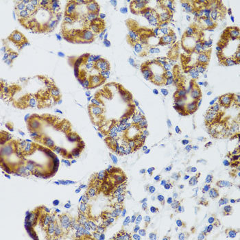 Immunohistochemistry of paraffin-embedded Human stomach using RIPK4 Polyclonal Antibody at dilution of  1:100 (40x lens).