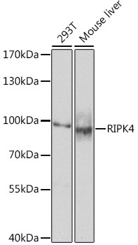 Western blot analysis of extracts of various cell lines using RIPK4 Polyclonal Antibody at dilution of 1:1000.