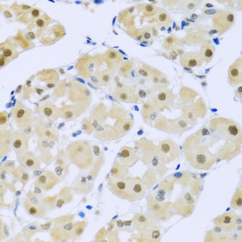 Immunohistochemistry of paraffin-embedded Human stomach using SMEK1 Polyclonal Antibody at dilution of  1:100 (40x lens).