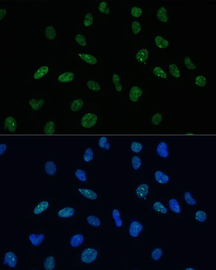 Immunofluorescence analysis of U-2 OS cells using MKL1 Polyclonal Antibody at dilution of  1:100 (40x lens). Blue: DAPI for nuclear staining.