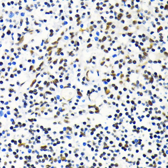 Immunohistochemistry of paraffin-embedded Human tonsil using MKL1 Polyclonal Antibody at dilution of  1:100 (40x lens).