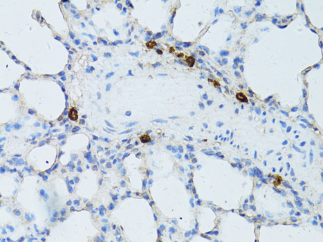 Immunohistochemistry of paraffin-embedded Rat lung using TEFM Polyclonal Antibody at dilution of  1:100 (40x lens).