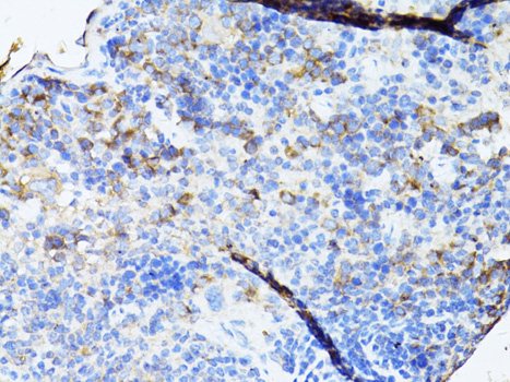 Immunohistochemistry of paraffin-embedded Mouse spleen using TEFM Polyclonal Antibody at dilution of  1:100 (40x lens).