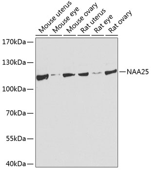 Western blot analysis of extracts of various cell lines using NAA25 Polyclonal Antibody at dilution of 1:1000.