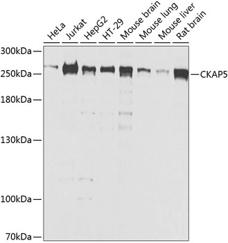 Western blot analysis of extracts of various cell lines using CKAP5 Polyclonal Antibody at dilution of 1:1000.