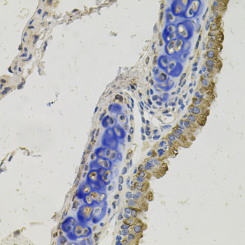 Immunohistochemistry of paraffin-embedded Mouse lung using GAS6 Polyclonal Antibody at dilution of  1:100 (40x lens).