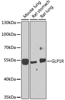 Western blot analysis of extracts of various cell lines using GLP1R Polyclonal Antibody at dilution of 1:1000.