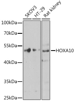 Western blot analysis of extracts of various cell lines using HOXA10 Polyclonal Antibody at dilution of 1:1000.