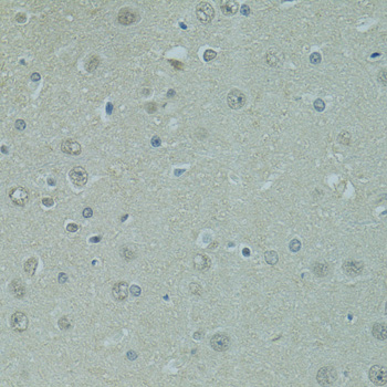 Immunohistochemistry of paraffin-embedded Rat brain using PRDM2 Polyclonal Antibody at dilution of  1:100 (40x lens).